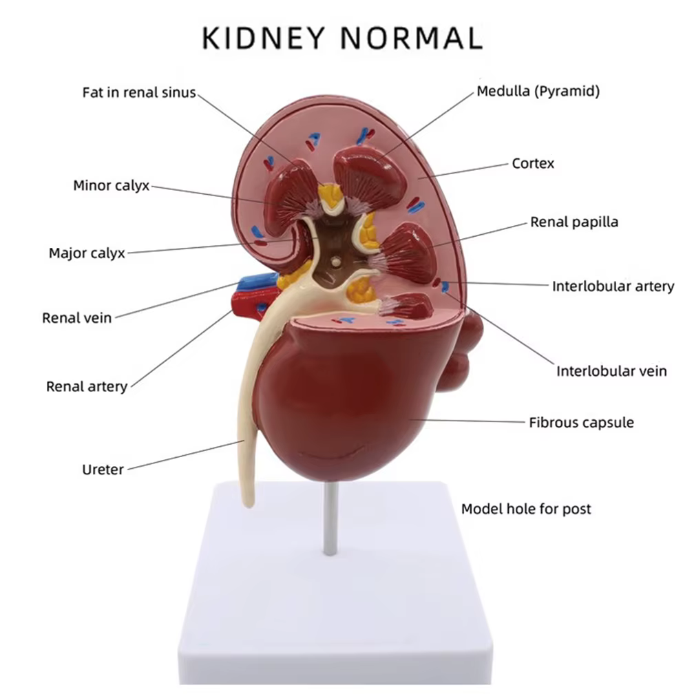 Modèle anatomique de rein normal et pathologique, système urinaire de rein malade, orgue, cadeau médical, équipement éducatif, enseignement