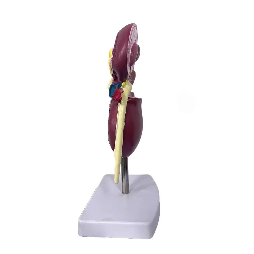 Modèle anatomique de rein normal et pathologique, système urinaire de rein malade, orgue, cadeau médical, équipement éducatif, enseignement